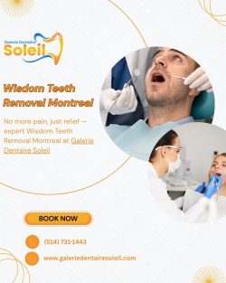 Wisdom Teeth Removal