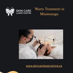 Warts Treatment in Mississauga