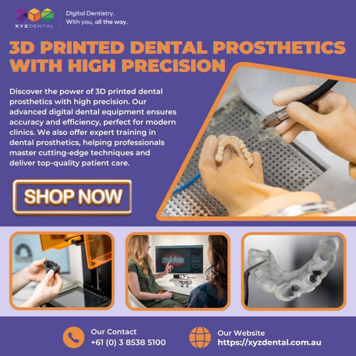 3D Printed Dental Prosthetics with High Precision