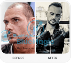 Restore Confidence with BlueMagic