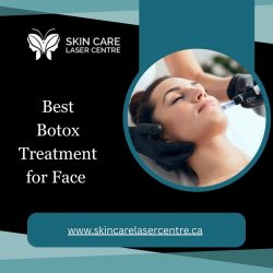 Best Botox Treatment for Face