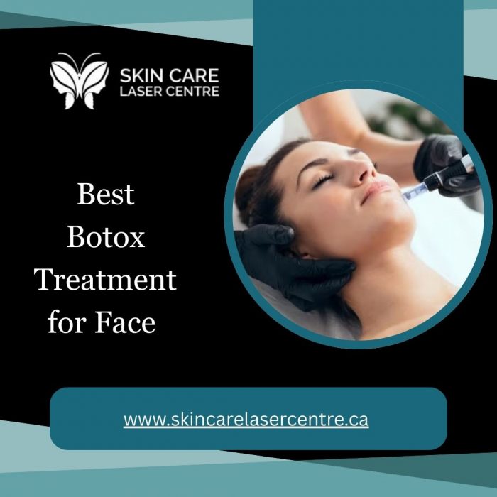 Best Botox Treatment for Face