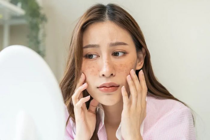 Online Dermatology NP Consultations California