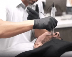 Professional Male Hair Removal Sydney | BareWolf