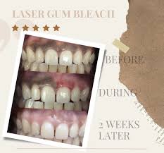 How Dangerous Is Untreated Sleep Apnea in Houston?