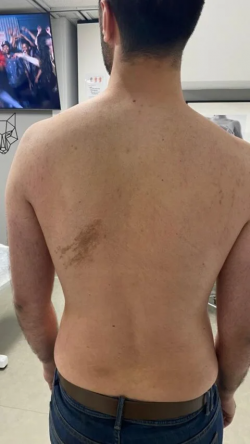 Smooth Results with Men’s Laser Hair Removal Blacktown Services