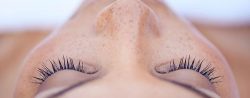 Laser treatment for face pigmentation