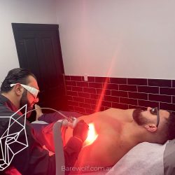 Advanced Skin Needling Sydney Treatments for Clearer Skin
