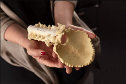 Adult Brain Tumour Specialist in Sydney