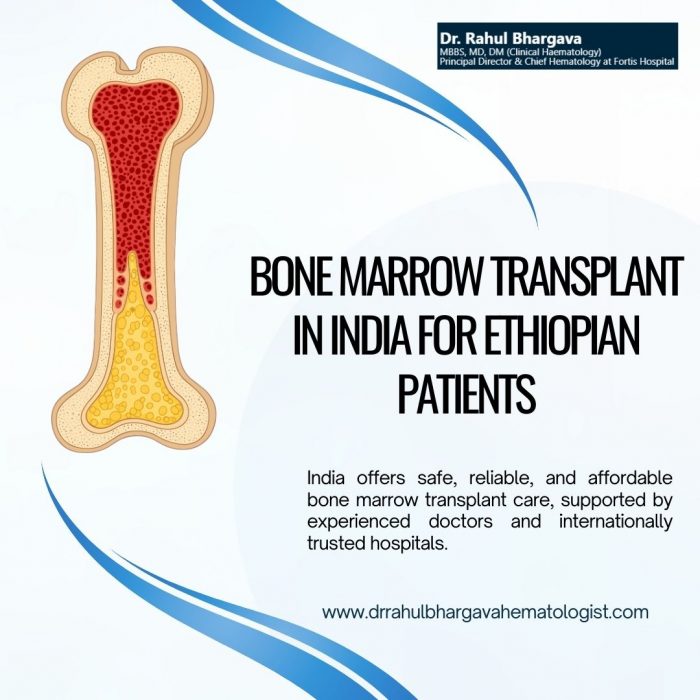 Affordable Bone Marrow Transplant in India for Ethiopian Patients