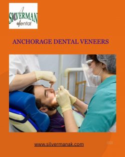 Anchorage Dental Veneers