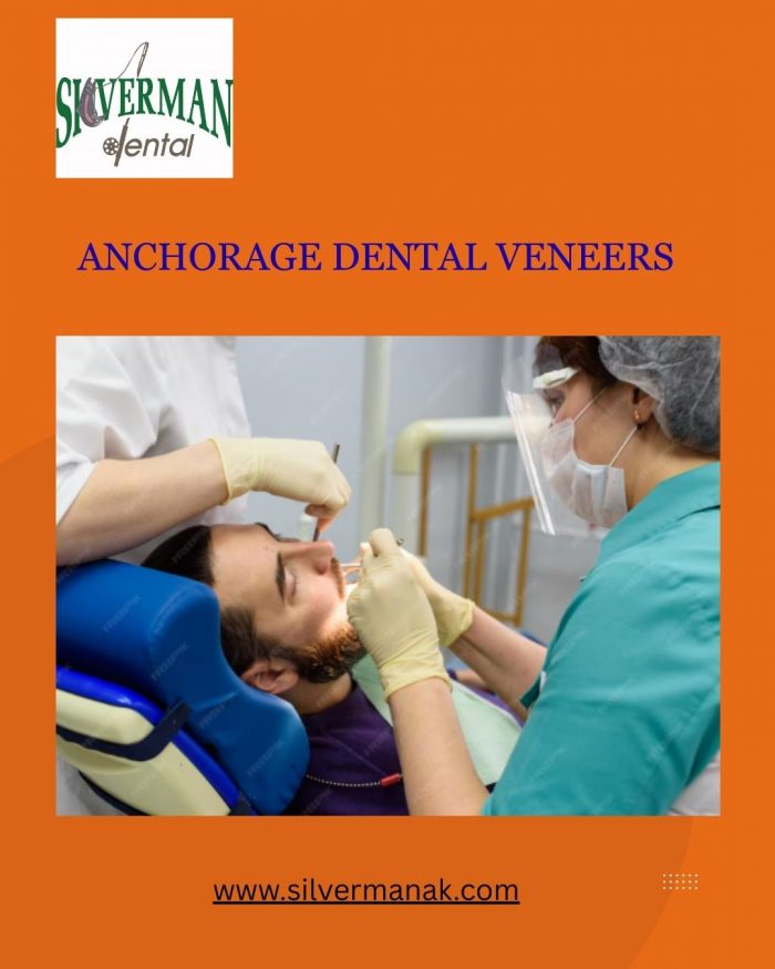 Anchorage Dental Veneers