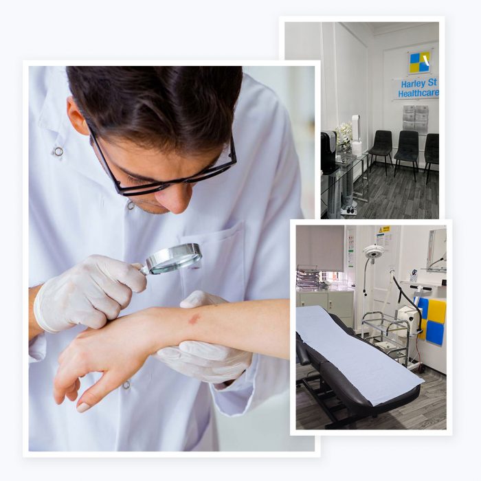 Harley Street Clinic Dermatology – Expert Skin Care at London Dermatology Clinics