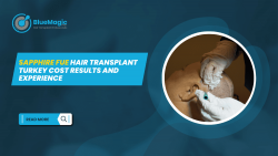 Sapphire FUE Hair Transplant Turkey Cost Results and Experience
