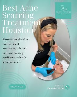 Best Acne Scarring Treatment Houston for Radiant, Even-Toned Skin
