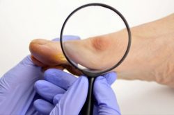 Advanced Foot Pain Treatments: From Big Toe Arthritis to Achilles Tendinopathy and Hammer Toe Care