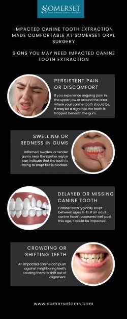 Impacted canine tooth extraction made comfortable at Somerset Oral Surgery