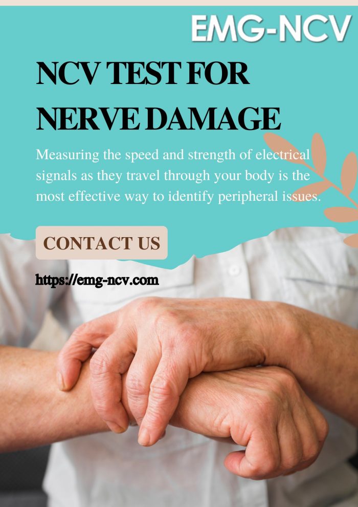 NCV test for nerve damage