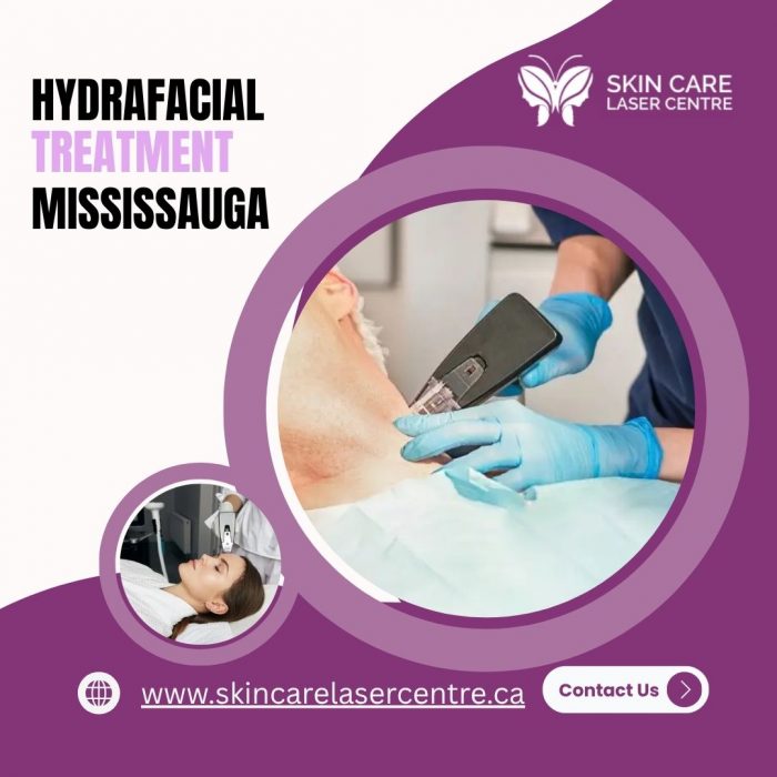 Hydrafacial Treatment Mississauga