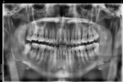 Dental care in Tijuana
