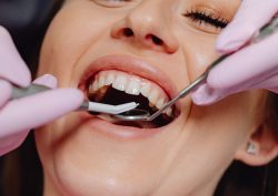 Trusted Dentist Gordon for Complete Family Dental Care