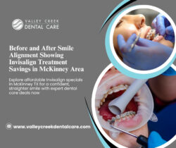 Clear Orthodontic Solutions Designed for Everyday Smile Improvement in McKinney TX