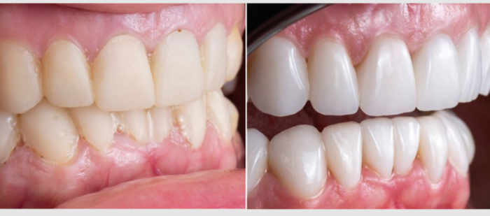 Emergency Dentist Warrawee: Fast and Reliable Care When Dental Emergencies Strike