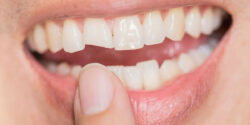 Dentist St Ives – Quality Dental Care for Every Smile