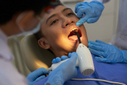 Dental Filling Treatments in Bundoora At Smile White Dental, we provide high-quality dental fill ...