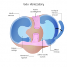 Find Practical Options for Osteoarthritis Treatment