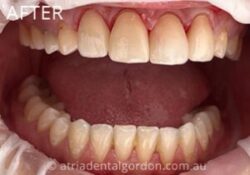 Emergency Dentist Castle Cove – Fast and Reliable Dental Care When You Need It Most