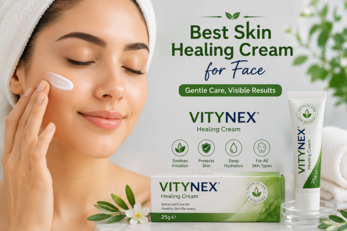 Best Skin Healing Cream for Face – Vitynex