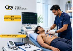 ECG: Reading the Rhythm of Your Heart
