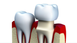 Dentist South Turramurra for Quality Dental Care | Atria Dental Gordon