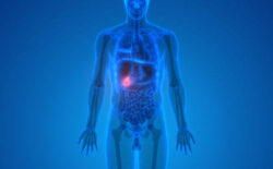 Dr. Kyriakos Neofytou: Recognizing Gallstone Symptoms and Understanding Digestive Health