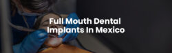 Full mouth dental implants in Mexico