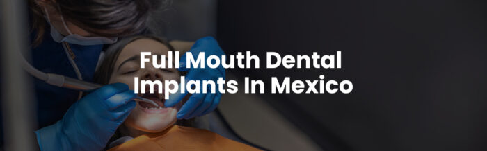 Full mouth dental implants in Mexico