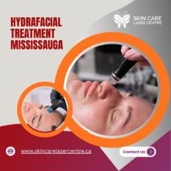 Hydrafacial Treatment Mississauga