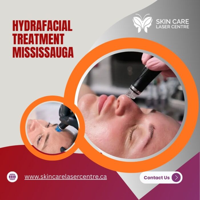 Hydrafacial Treatment Mississauga