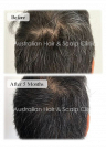 Support Healthy Growth with Hair Follicle Regeneration