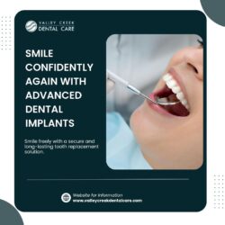 Dental Implants for Better Function, Comfort, and Health