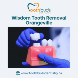 Wisdom Tooth Removal Orangeville