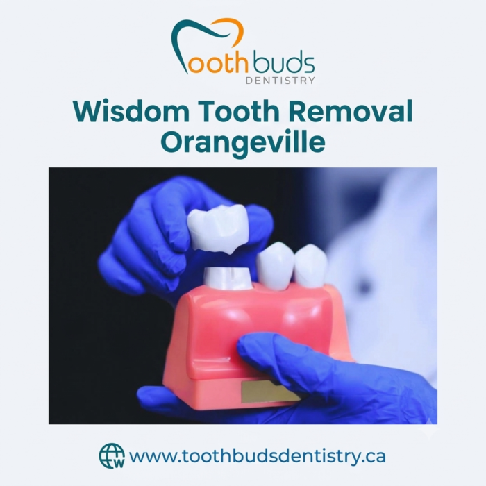 Wisdom Tooth Removal Orangeville