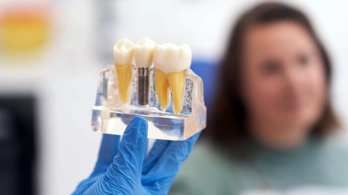 Dentist in Vancouver BC and Dentists Downtown Vancouver: What to Look for and Why Bright Smiles on G