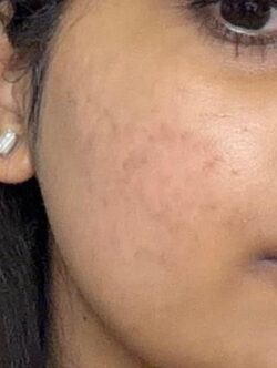Locate Dermatologist near me for Dedicated Skin Care