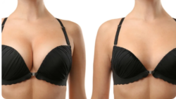 Experience specialized care at our premier breast clinic pune today.